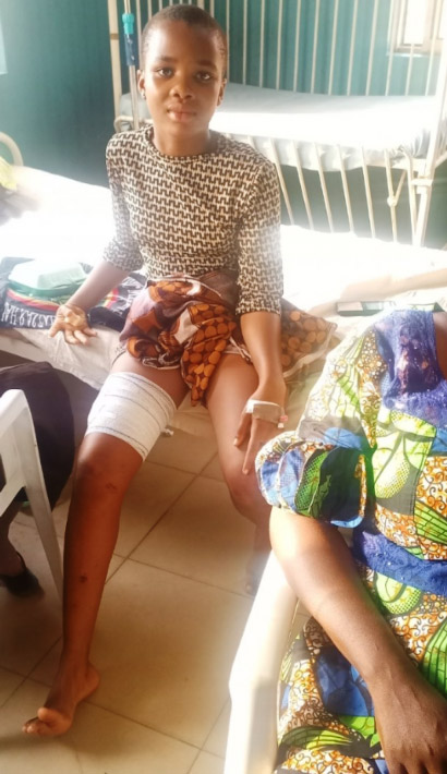 Afrikanisches Mädchen zeigt seinen Verband nach einer Verletzung am Bein